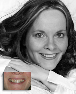 Cosmetic Dentistry in Cornwall